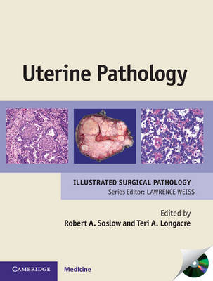 Uterine Pathology - Robert A. Soslow, Teri A. Longacre