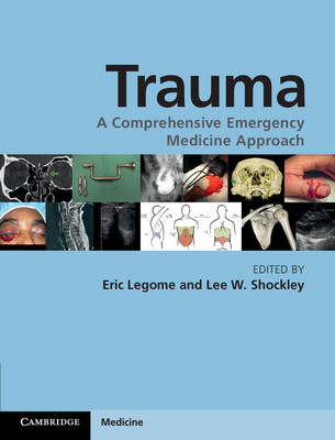 Trauma - 