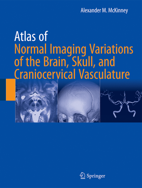 Atlas of Normal Imaging Variations of the Brain, Skull, and Craniocervical Vasculature - Alexander M. McKinney
