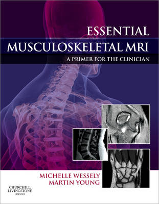 Essential Musculoskeletal MRI - Michelle Anna Wessely, Martin Ferrier Young