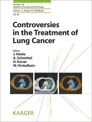 Controversies in the Treatment of Lung Cancer - 