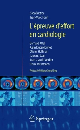 L'épreuve d'effort en cardiologie - 