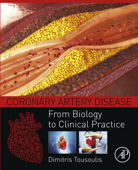 Coronary Artery Disease -  Dimitris Tousoulis