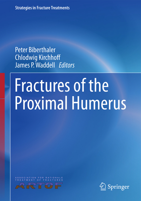 Fractures of the Proximal Humerus - 