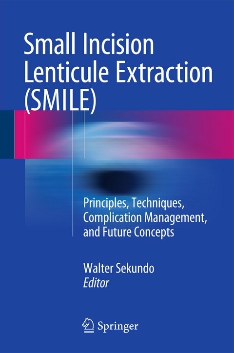 Small Incision Lenticule Extraction (SMILE) - 