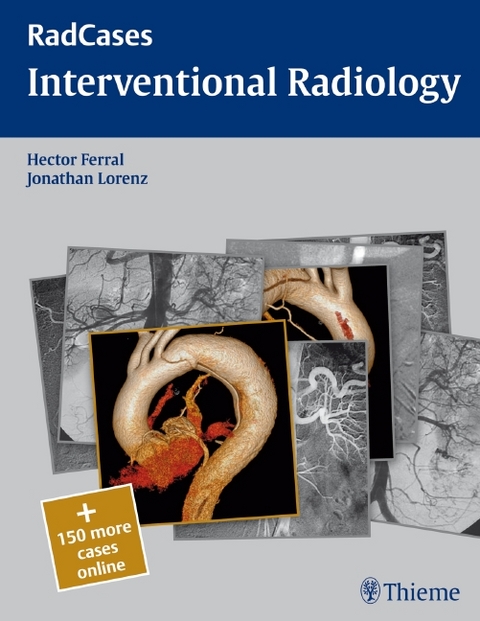 Radcases Interventional Radiology - Hector Ferral