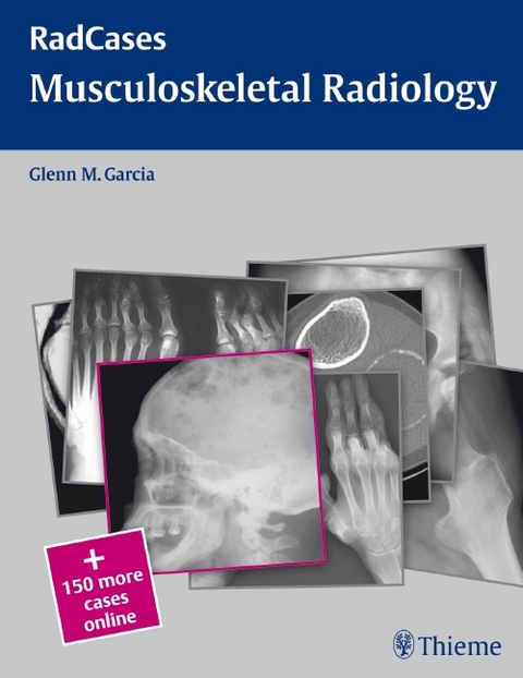 Radcases Musculoskeletal Radiology - 