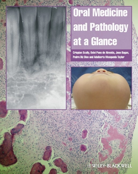 Oral Medicine and Pathology at a Glance - Crispian Scully, Oslei Paes de Almeida, Jose V. Bagan, Pedro Diz Dios, Adalberto Mosqueda Taylor