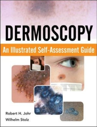 Dermoscopy: An Illustrated Self-Assessment Guide - Robert Johr, Wilhelm Stolz