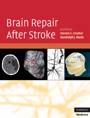 Brain Repair After Stroke - 