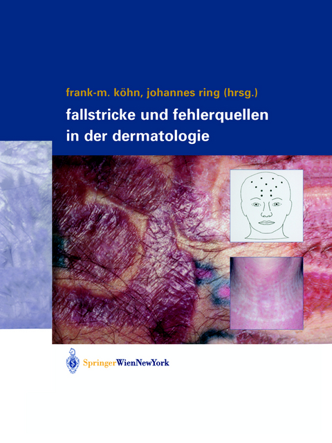 Fallstricke und Fehlerquellen in der Dermatologie - 