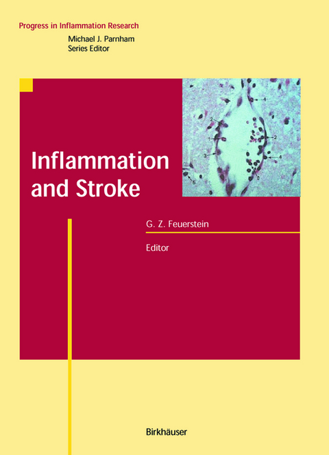 Inflammation and Stroke - 