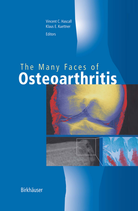 The Many Faces of Osteoarthritis - 