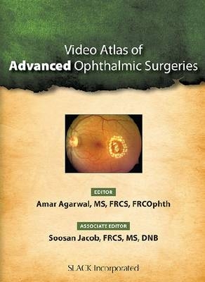 Video Atlas of Advanced Ophthalmic Surgeries - Amar Agarwal