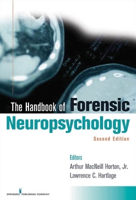 The Handbook of Forensic Neuropsychology - 