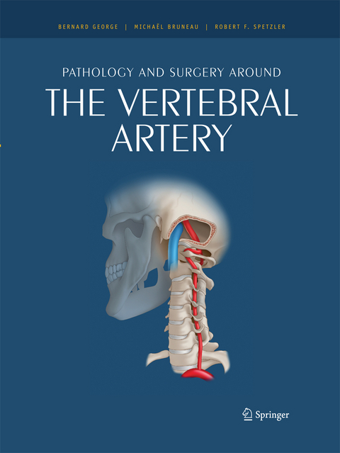Pathology and surgery around the vertebral artery - 