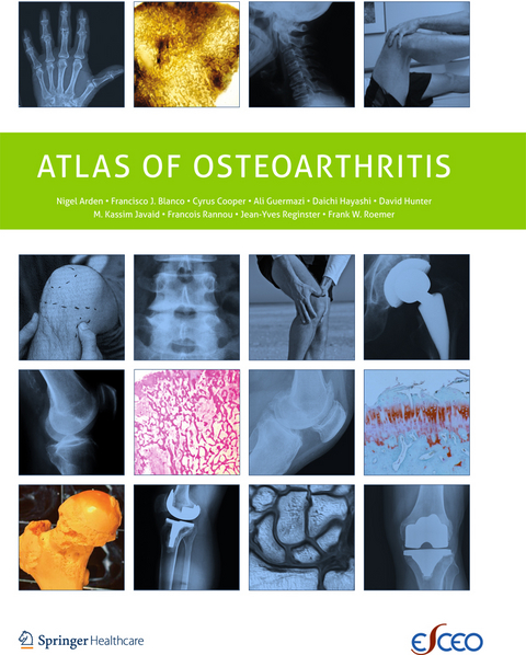 Atlas of Osteoarthritis - Nigel Arden, Francisco Blanco, C. Cooper, Ali Guermazi, Daichi Hayashi