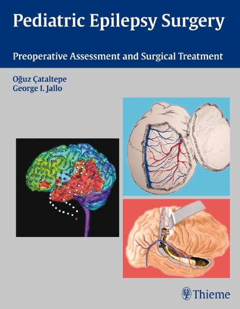 Pediatric Epilepsy Surgery - 