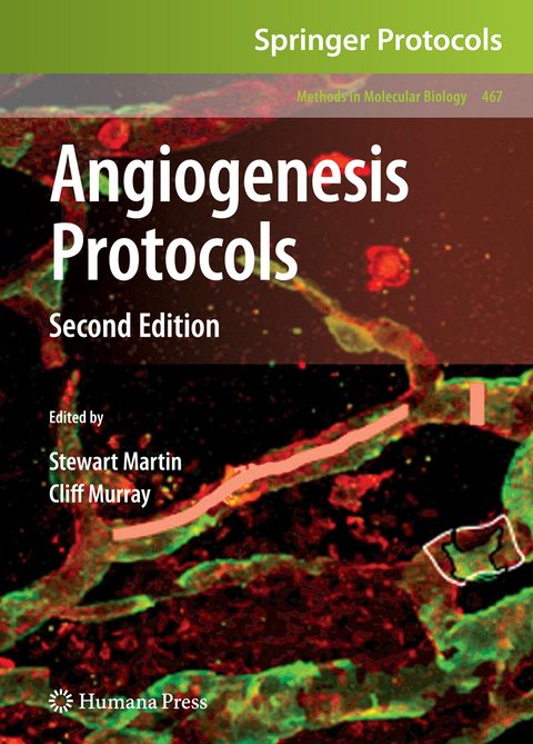 Angiogenesis Protocols - 