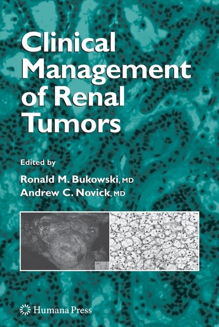 Clinical Management of Renal Tumors - 