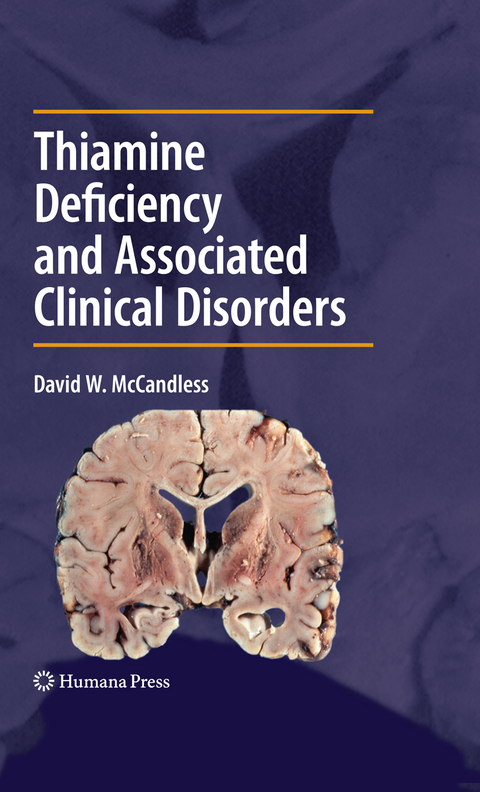 Thiamine Deficiency and Associated Clinical Disorders - David W. McCandless