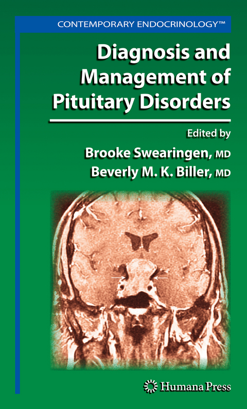 Diagnosis and Management of Pituitary Disorders - 