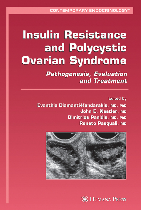 Insulin Resistance and Polycystic Ovarian Syndrome - 