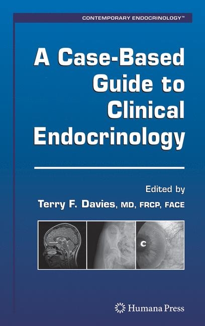 A Case-based Guide to Clinical Endocrinology - 