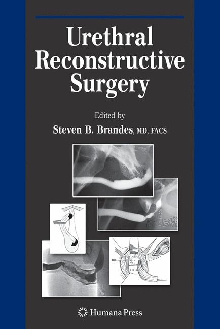 Urethral Reconstructive Surgery - 