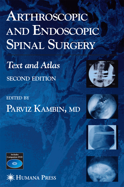 Arthroscopic and Endoscopic Spinal Surgery - 