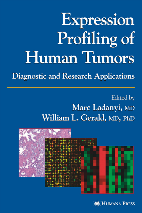 Expression Profiling of Human Tumors - 