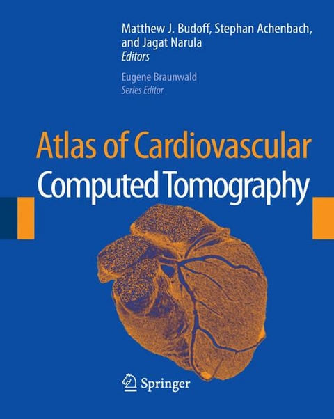 Atlas of Cardiovascular Computed Tomography - 