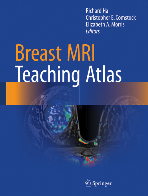 Breast MRI Teaching Atlas - 