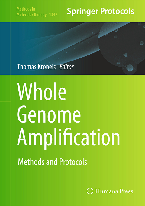 Whole Genome Amplification - 
