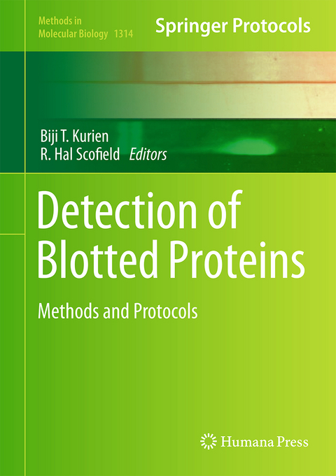 Detection of Blotted Proteins - 