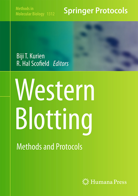 Western Blotting - 