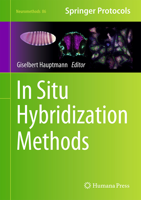 In Situ Hybridization Methods - 