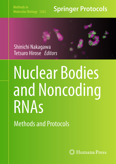 Nuclear Bodies and Noncoding RNAs - 