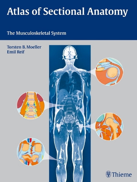 Atlas of Sectional Anatomy - Torsten Bert Möller, Emil Reif