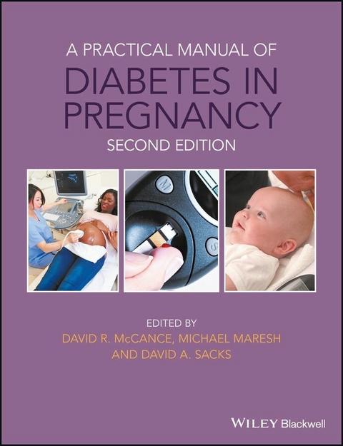 Practical Manual of Diabetes in Pregnancy - 