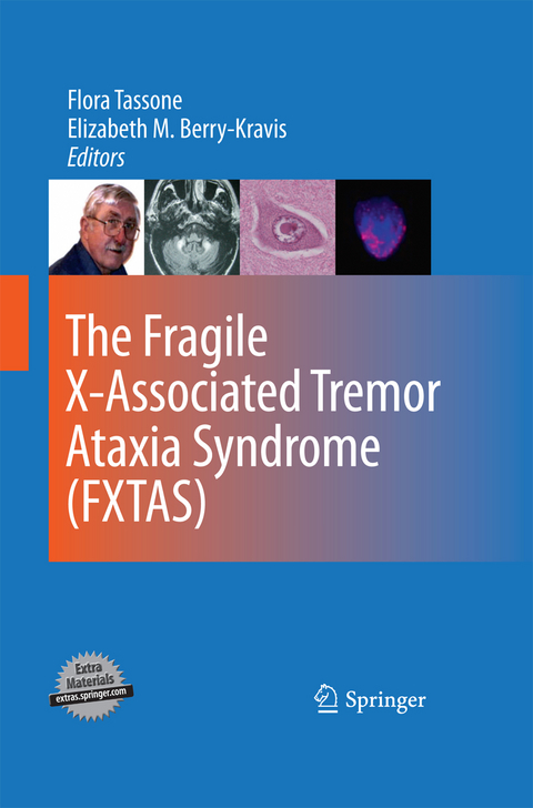 The Fragile X-Associated Tremor Ataxia Syndrome (FXTAS) - 