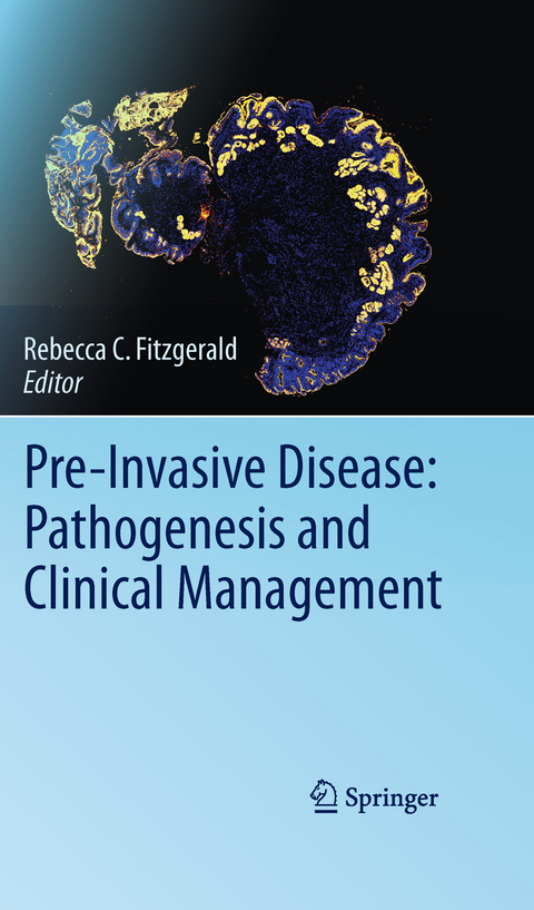 Pre-Invasive Disease: Pathogenesis and Clinical Management - 