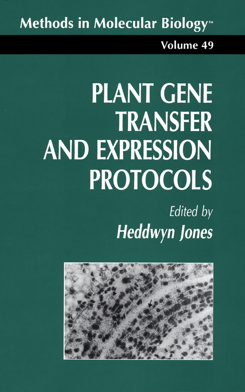 Plant Gene Transfer and Expression Protocols - Heddwyn Jones