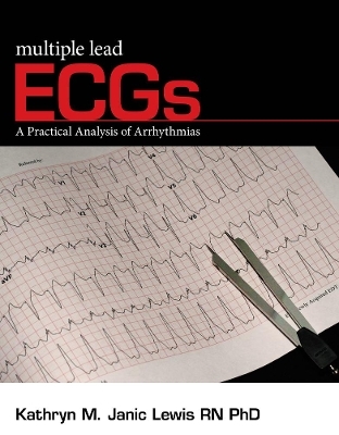 Multiple Lead ECGs - Kathryn Lewis