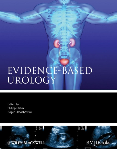 Evidence-Based Urology - 