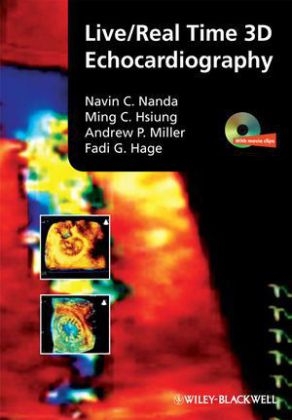 Live/Real Time 3D Echocardiography - Navin Nanda, Ming Chon Hsiung, Andrew P. Miller, Fadi G. Hage
