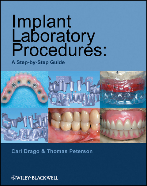 Implant Laboratory Procedures -  Carl Drago,  Thomas Peterson