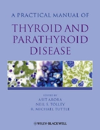 Practical Manual of Thyroid and Parathyroid Disease - 