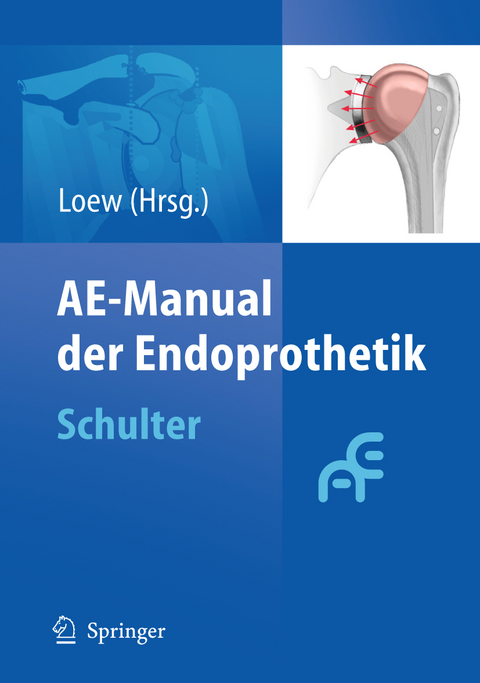 AE-Manual der Endoprothetik - 