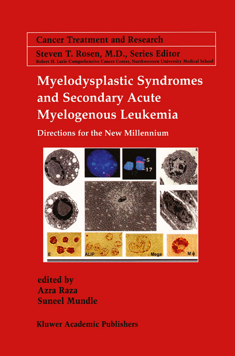 Myelodysplastic Syndromes & Secondary Acute Myelogenous Leukemia - 